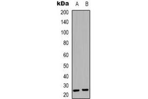 Western blot analysis of Syndecan 4 expression in Jurkat (A), HepG2 (B) whole cell lysates. (SDC4 Antikörper  (C-Term))