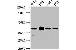 Western Blot Positive WB detected in: Hela whole cell lysate, LO2 whole cell lysate, A549 whole cell lysate, PC-3 whole cell lysate All lanes: VN1R1 antibody at 3. (VN1R1 Antikörper  (AA 1-56))