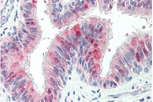 ABIN335141 (5µg/ml) staining of paraffin embedded Human Lung. (ZDHHC13 Antikörper  (C-Term))