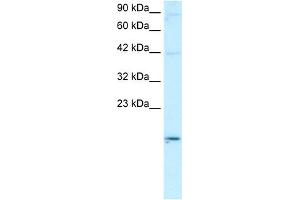 WB Suggested Anti-APOBEC3G Antibody Titration:  0. (APOBEC3G Antikörper  (N-Term))