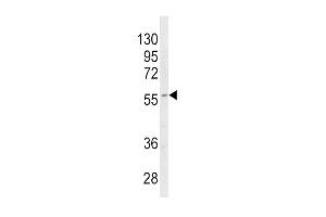 Western blot analysis of CYP4B1 Antibody (Center) (ABIN652592 and ABIN2842397) in MDA-M cell line lysates (35 μg/lane). (CYP4B1 Antikörper  (AA 331-362))