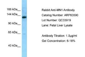 Western Blotting (WB) image for anti-MN1 proto-oncogene (MN1) (C-Term) antibody (ABIN2789559) (Meningioma 1 Antikörper  (C-Term))