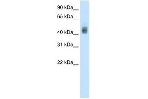 WB Suggested Anti-SOX3 Antibody Titration:  1. (SOX3 Antikörper  (N-Term))