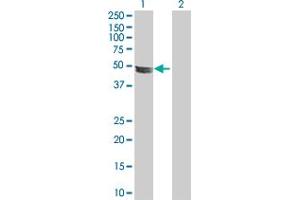 Western Blot analysis of ADCK4 expression in transfected 293T cell line by ADCK4 MaxPab polyclonal antibody. (ADCK4 Antikörper  (AA 1-503))