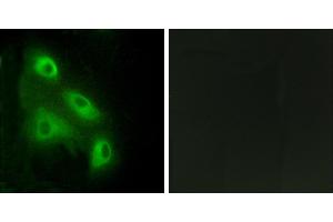 Peptide - +Immunohistochemistry analysis of paraffin-embedded human colon carcinoma tissue, using ES8L3 antibody.