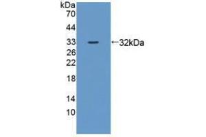 Western blot analysis of recombinant Mouse ZRF1. (DNAJC2 Antikörper  (AA 368-621))