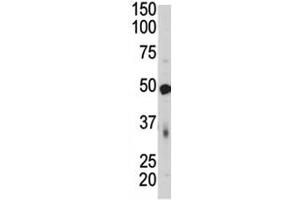 Western Blotting (WB) image for anti-Pyruvate Dehydrogenase Kinase, Isozyme 4 (PDK4) (AA 382-410) antibody (ABIN3028963)