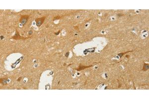 Immunohistochemistry of paraffin-embedded Human brain using KLC1 Polyclonal Antibody at dilution of 1:40 (KLC1 Antikörper)