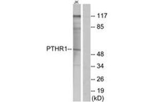 Western blot analysis of extracts from Jurkat cells, using PTHR1 Antibody. (PTH1R Antikörper  (AA 145-194))