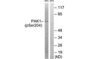 Western blot analysis of extracts from NIH-3T3 cells treated with UV 15', using PAK1 (Phospho-Ser204) Antibody. (PAK1 Antikörper  (pSer204))