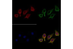 ABIN6258589 and ABIN6275045 staining Hela cells by IF/ICC. (ATG4C Antikörper  (N-Term))