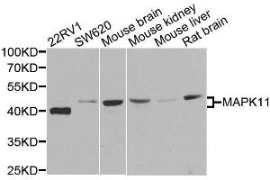 Western blot analysis of extracts of various cell lines, using MAPK11 antibody. (MAPK11 Antikörper)