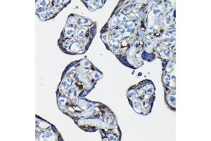 Immunohistochemistry (IHC) image for anti-Ran GTPase Activating Protein 1 (RANGAP1) (AA 398-587) antibody (ABIN6146681)
