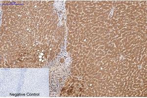 Immunohistochemical analysis of paraffin-embedded human liver tissue. (HSV Tag Antikörper)