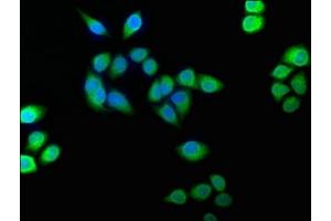 Immunofluorescence staining of Hela cells with ABIN7152961 at 1:100, counter-stained with DAPI. (BLVRB Antikörper  (AA 2-206))