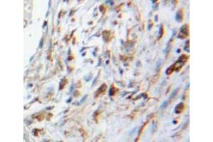 Used in DAB staining on fromalin fixed paraffin-embedded lung tissue (S100A6 Antikörper  (AA 1-89))