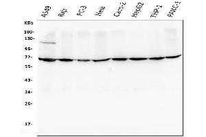Western blot analysis of AIF using anti-AIF antibody (ABIN6719266).