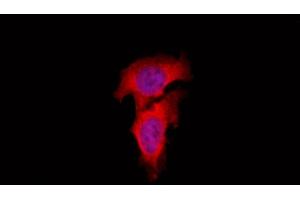 ABIN6262447 and ABIN6266925 staining Hela by IF/ICC. (EIF3L Antikörper  (N-Term))