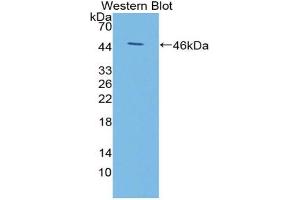 Western blot analysis of the recombinant protein. (KISS1 Antikörper  (AA 1-126))