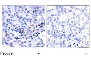 Image no. 1 for anti-Nuclear Factor of kappa Light Polypeptide Gene Enhancer in B-Cells 1 (NFKB1) (Ser337) antibody (ABIN197123) (NFKB1 Antikörper  (Ser337))