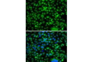 Immunofluorescence analysis of A-549 cells using PHYHD1 antibody (ABIN6133210, ABIN6145585, ABIN6145586 and ABIN6223037). (PHYHD1 Antikörper  (AA 1-291))