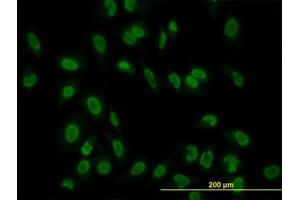 Image no. 2 for anti-TATA Box Binding Protein Associated Factor 11 (TAF11) (AA 158-211) antibody (ABIN598955) (TAF11 Antikörper  (AA 158-211))