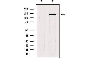 Western blot analysis of extracts from 293, using lats1/2 Antibody. (LATS1 Antikörper  (Internal Region))