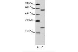Image no. 2 for anti-Copine I (CPNE1) (AA 75-124) antibody (ABIN203200) (CPNE1 Antikörper  (AA 75-124))