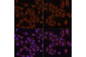 Immunofluorescence analysis of HeLa cells using MAP1LC3B antibody. (LC3B Antikörper)