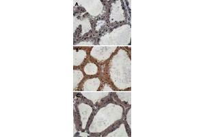 Immunohistochemistry staining of mouse mammary gland samples from lactating mice (L10) with Eif2ak3 polyclonal antibody . (PERK Antikörper  (AA 601-1115))