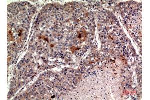 Immunohistochemistry (IHC) analysis of paraffin-embedded Human Lung, antibody was diluted at 1:100. (RANKL Antikörper  (C-Term))