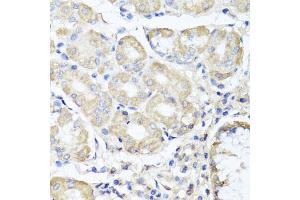Immunohistochemistry of paraffin-embedded human stomach using OPA3 antibody (ABIN5975243) at dilution of 1/100 (40x lens).