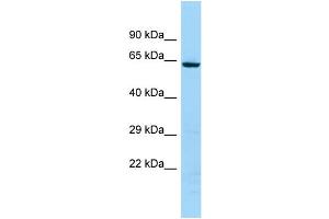 WB Suggested Anti-KRT74 Antibody Titration: 1. (KRT74 Antikörper  (C-Term))
