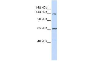 PCDH12 antibody used at 1 ug/ml to detect target protein. (PCDH12 Antikörper  (Middle Region))