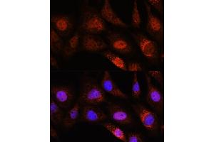 Immunofluorescence analysis of NIH/3T3 cells using ZC3H12D Rabbit pAb (ABIN7271448) at dilution of 1:100. (ZC3H12D Antikörper  (AA 150-230))
