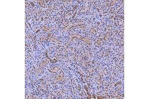 IHC analysis of SNRNP200 using anti-SNRNP200 antibody (ABIN7602032). (SNRNP200 Antikörper  (AA 557-2129))