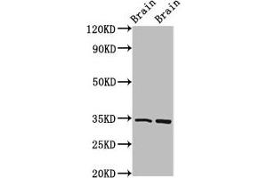 Western Blot Positive WB detected in: Mouse brain tissue, Rat brain tissue All lanes: FOXE3 antibody at 4 μg/mL Secondary Goat polyclonal to rabbit IgG at 1/50000 dilution Predicted band size: 34 kDa Observed band size: 34 kDa (FOXE3 Antikörper  (AA 4-74))