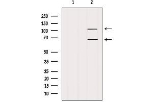 Western blot analysis of extracts from Mouse lung, using FAM65B Antibody. (FAM65B Antikörper)