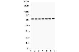 Western blot testing of FOXO3A antibody and Lane 1:  rat thymus;  2: (r) NRK;  3: (r) PC12;  4: human HEPG2;  5: (h) HeLa;  6: (h) K562;  7: (h) Jurkat. (FOXO3 Antikörper  (AA 471-673))