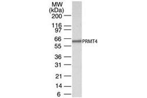 Western Blotting (WB) image for anti-Coactivator-Associated Arginine Methyltransferase 1 (CARM1) (AA 45-69) antibody (ABIN208355) (CARM1 Antikörper  (AA 45-69))