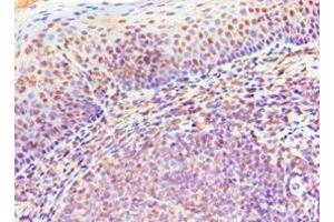 Immunohistochemistry (IHC) image for anti-Membrane-Spanning 4-Domains, Subfamily A, Member 1 (MS4A1) (AA 209-297) antibody (ABIN7145182)