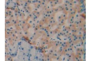 Detection of DBP in Rat Pancreas Tissue using Monoclonal Antibody to Vitamin D Binding Protein (DBP) (Vitamin D-Binding Protein Antikörper  (AA 209-394))