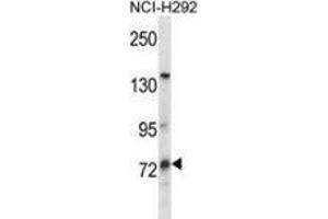 Western blot analysis in NCI-H292 cell line lysates (35ug/lane) using MUM1L1 Antibody . (MUM1L1 Antikörper  (Middle Region))