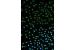 Immunofluorescence analysis of MCF7 cell using DDB2 antibody. (DDB2 Antikörper)