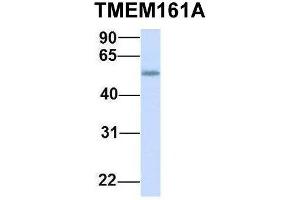 Host:  Rabbit  Target Name:  TMEM161A  Sample Type:  Human Fetal Heart  Antibody Dilution:  1. (TMEM161A Antikörper  (Middle Region))