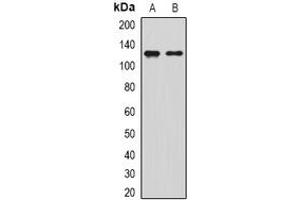 Western blot analysis of SIRT1 expression in Jurkat (A), MCF7 (B) whole cell lysates. (SIRT1 Antikörper)