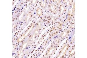 Immunohistochemistry of paraffin embedded mouse kidney using MECOM (ABIN7074575) at dilution of 1: 2200 (400x lens) (MECOM Antikörper)