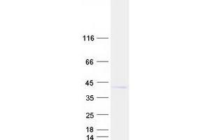 Western Blotting (WB) image for Xylosylprotein beta 1,4-Galactosyltransferase, Polypeptide 7 (Galactosyltransferase I) (B4GALT7) protein (Myc-DYKDDDDK Tag) (ABIN2715127)