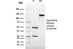 SDS-PAGE Analysis Purified CD35 Mouse Monoclonal Antibody (SPM554). (CD35 Antikörper)