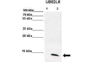WB Suggested Anti-UBE2L6 Antibody  Positive Control: Lane1: 70ug U6A lysate, Lane, 2: 70ug IFN-g stimulated U6A lysate  Primary Antibody Dilution :  1:2000 Secondary Antibody :  Anti-rabbit-HRP  Secondry Antibody Dilution :  1:5000 Submitted by: Torsten Ginter & Dr.